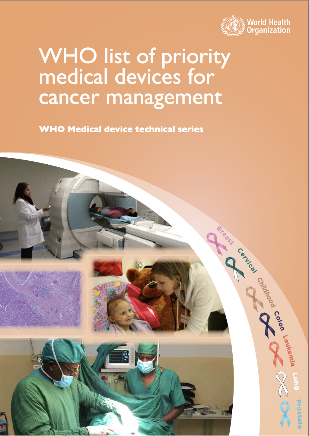 WHO list of priority medical devices for cancer management