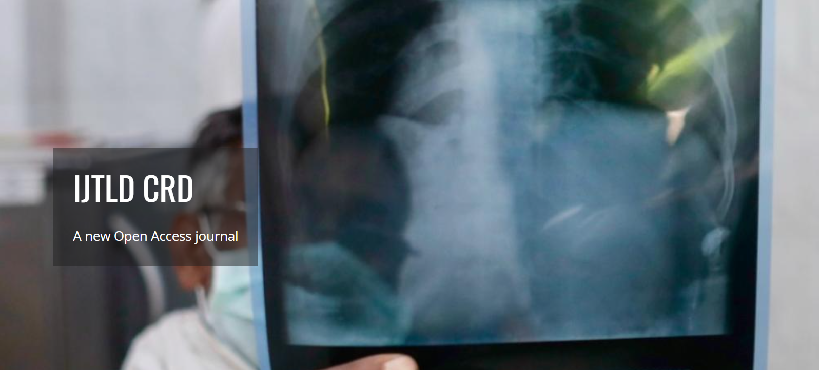 

<!-- THEME DEBUG -->
<!-- THEME HOOK: 'field' -->
<!-- FILE NAME SUGGESTIONS:
   ▪️ field--node--title--community-noticeboard.html.twig
   ✅ field--node--title.html.twig
   ▪️ field--node--community-noticeboard.html.twig
   ▪️ field--title.html.twig
   ▪️ field--string.html.twig
   ▪️ field.html.twig
-->
<!-- 💡 BEGIN CUSTOM TEMPLATE OUTPUT from 'themes/custom/whokap/templates/field/field--node--title.html.twig' -->
Call for papers: IJTLD Chronic Respiratory Disease (IJTLD CRD)
<!-- END CUSTOM TEMPLATE OUTPUT from 'themes/custom/whokap/templates/field/field--node--title.html.twig' -->

