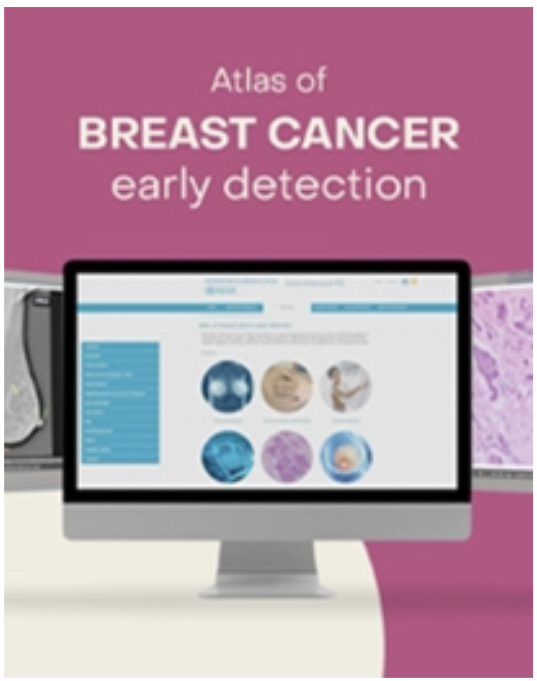 <!-- THEME DEBUG -->
<!-- THEME HOOK: 'field' -->
<!-- FILE NAME SUGGESTIONS:
▪️ field--node--title--community-noticeboard.html.twig
✅ field--node--title.html.twig
▪️ field--node--community-noticeboard.html.twig
▪️ field--title.html.twig
▪️ field--string.html.twig
▪️ field.html.twig
-->
<!-- 💡 BEGIN CUSTOM TEMPLATE OUTPUT from 'themes/custom/whokap/templates/field/field--node--title.html.twig' -->
Online learning resources by IARC on breast cancer early detection now available in Russian
<!-- END CUSTOM TEMPLATE OUTPUT from 'themes/custom/whokap/templates/field/field--node--title.html.twig' -->
